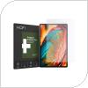 Tempered Glass Hofi Premium Pro+ Lenovo Tab P11 11.0''/ P11 Plus 11.0'' (1 τεμ.)